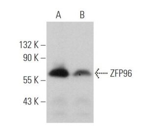 ZFP96 Antibody (A-6) - Western Blotting - Image 375956 
