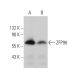 ZFP96 Antibody (A-6) - Western Blotting - Image 375956 