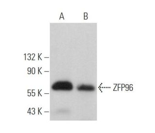 ZFP96 Antibody (G-11) - Western Blotting - Image 375962 