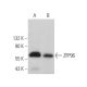 ZFP96 Antibody (G-11) - Western Blotting - Image 375962 