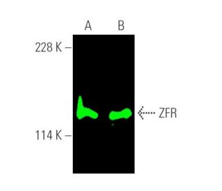 ZFR Antibody (B-8) - Western Blotting - Image 389652 