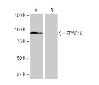 ZFYVE16 Antibody (1H6) - Western Blotting - Image 65101