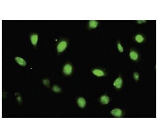 ZFYVE19 Antibody (J-24) - Immunofluorescence - Image 35776 