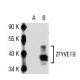 ZFYVE19 Antibody (J-24) - Western Blotting - Image 54147