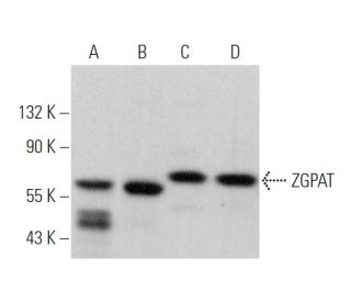 ZGPAT Antibody (B-3) - Western Blotting - Image 375874 