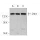 ZHX1 Antibody (E-6) - Western Blotting - Image 369366