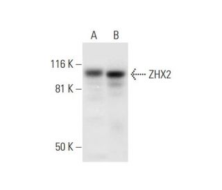 ZHX2 Antibody (D-2) - Western Blotting - Image 295746 