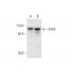 ZHX2 Antibody (D-2) - Western Blotting - Image 295746 