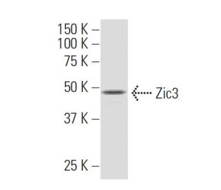 western blotting image from recommended Zic3 (SQ-15) monoclonal antibody replacement. Image 34562