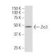 western blotting image from recommended Zic3 (SQ-15) monoclonal antibody replacement. Image 34562