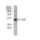 Zic4 Antibody (RY-6) - Western Blotting - Image 34563 