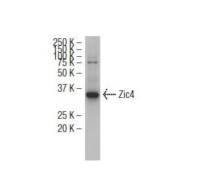 Zic4 Antibody (RY-6) - Western Blotting - Image 34563The Double Nickase Plasmid features a U6 promoter for sgRNA expression, a 20 nt targeting sequence, and a gRNA scaffold to guide Cas9n. It includes a CBh promoter for Cas9n (D10A) and puromycin resistance, GFP for transfection verification, and nuclear localization signals (NLS). The 2A peptide allows co-expression of Cas9n and Puro from a single promoter, enabling precise genome editing with reduced off-target effects.