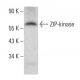 ZIP-kinase Antibody (C-3) - Western Blotting - Image 382333