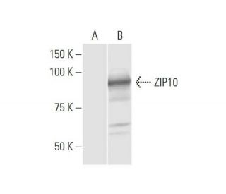 ZIP10 Antibody (1F6) - Western Blotting - Image 352205 