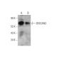 ZKSCAN3 Antibody (A-10) - Western Blotting - Image 344701