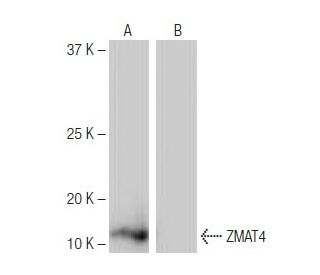 ZMAT4 Antibody (1-RY28) - Western Blotting - Image 65102