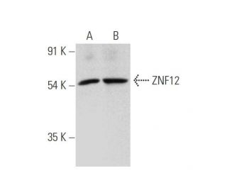 ZNF12 Antibody (F-5) - Western Blotting - Image 319989 