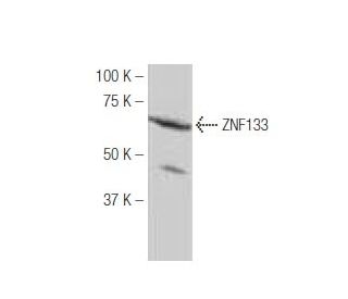 ZNF133 Antibody (9V2) - Western Blotting - Image 53913