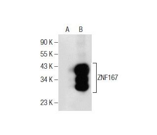ZNF167 Antibody (G-4) - Western Blotting - Image 155220