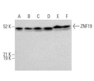ZNF19 Antibody (B-11) - Western Blotting - Image 370894 