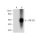 ZNF193 Antibody (F-8) - Western Blotting - Image 308085