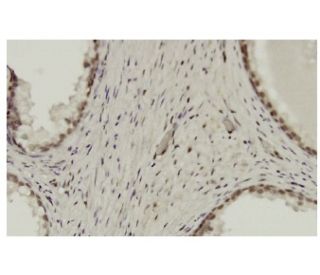 ZNF202 Antibody (GG-7) - Immunohistochemistry - Image 36280 