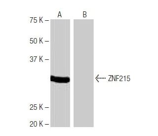 ZNF215 Antibody (6L1) - Western Blotting - Image 65106