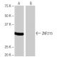 ZNF215 Antibody (6L1) - Western Blotting - Image 65106