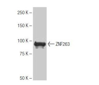 ZNF263 Antibody (8-YD33) - Western Blotting - Image 65107The Double Nickase Plasmid features a U6 promoter for sgRNA expression, a 20 nt targeting sequence, and a gRNA scaffold to guide Cas9n. It includes a CBh promoter for Cas9n (D10A) and puromycin resistance, GFP for transfection verification, and nuclear localization signals (NLS). The 2A peptide allows co-expression of Cas9n and Puro from a single promoter, enabling precise genome editing with reduced off-target effects.