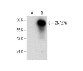 ZNF276 Antibody (F-10) - Western Blotting - Image 301531