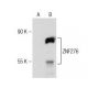 ZNF276 Antibody (G-9) - Western Blotting - Image 147353