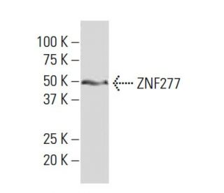 ZNF277 Antibody (SS-17) - Western Blotting - Image 34346