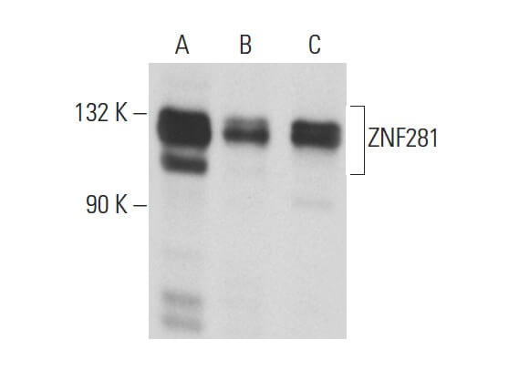 ZNF281抗体(D-8) | SCBT - Santa Cruz Biotechnology