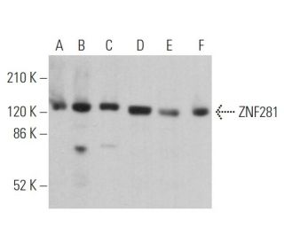 ZNF281 Antibody (D-8) - Western Blotting - Image 361922 
