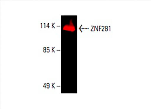 ZNF281 Antibody (D-8) | SCBT - Santa Cruz Biotechnology