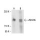 ZNF295 Antibody (D-8) - Western Blotting - Image 411085 