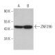 ZNF296 Antibody (C-12) - Western Blotting - Image 366823 