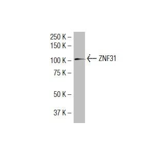 ZNF31 Antibody (MM-9) - Western Blotting - Image 34450 