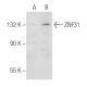 ZNF31 Antibody (MM-9) - Western Blotting - Image 48746