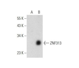 ZNF313 Antibody (A-9) - Western Blotting - Image 331165