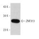 ZNF313 Antibody (E-12) - Western Blotting - Image 387372 