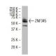 ZNF345 Antibody (38-H) - Western Blotting - Image 34447