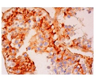ZNF35 Antibody (C-11) - Immunohistochemistry - Image 315745 