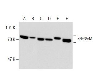 ZNF354A Antibody (149C1a) - Western Blotting - Image 147196 
