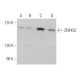 ZNF452 Antibody (G-11) - Western Blotting - Image 373515