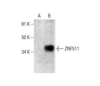 ZNF511 Antibody (H-10) - Western Blotting - Image 291839