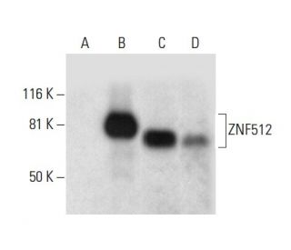 ZNF512 Antibody (A-1) - Western Blotting - Image 301438 