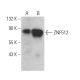 ZNF512 Antibody (A-1) - Western Blotting - Image 372070