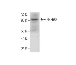 ZNF588 Antibody (F-11) - Western Blotting - Image 333667 