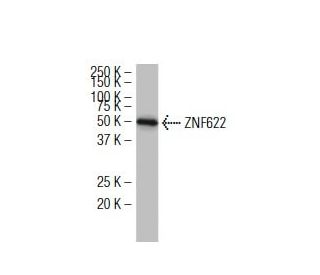 ZNF622 Antibody (3I4) - Western Blotting - Image 34345 